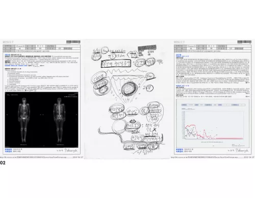 Jason Sangik Noh, Sig. Yoo, anni 56, Donam-Dong, C49.4 Sarcoma osteogenico extrascheletrico, 2012. Courtesy of the VHS-MC Board of Ethics