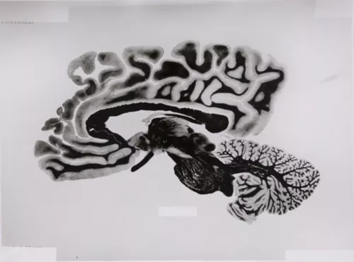Rossella Biscotti, 168 Sections of a Human Brain, 2009-14. Series of 108 silver gelatin prints on baryth paper, 30 x 40 cm each. Courtesy of the artist